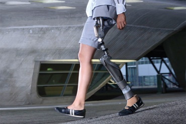 Protéza kyčelního kloubu s ložisky iglidur od společnosti Otto Bock HealthCare GmbH